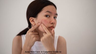 Acne Skin Care