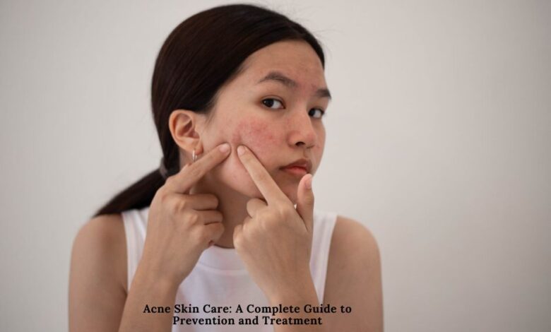 Acne Skin Care