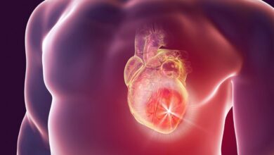 How to Protect Yourself Against Heart and Vascular Disease