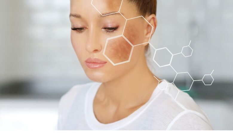 “How to Remove Dark Spots Fast