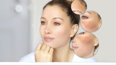 How to Remove Black Spots on Face Fast!: