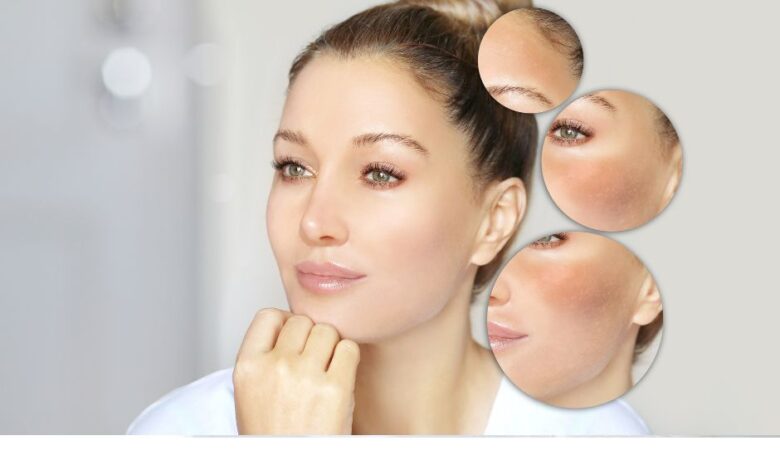 How to Remove Black Spots on Face Fast!: